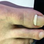 A Gentle Path to Better Feet in London