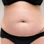 Safe Scar Camouflage in Dubai – natural, non-invasive solutions