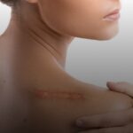 Facelift Malaysia: Rejuvenate Naturally with Expert Care