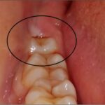 A Sparkling Smile Makeover for Everyday Confidence