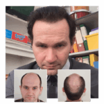 A Fresh Start: Rediscover Confidence After a Modern Hair Journey