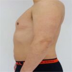 Botox Kuala Lumpur: Safe, Expert Treatments for Smooth Results