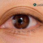 Pterygium Surgery Recovery: What to Expect and Care Tips