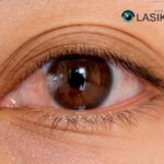 Eye Surgery Pterygium Removal: Safe, Expert Care in Houston