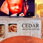 3D Baby Scan Perth – Capture Magical Moments at Cedar4D Ultrasound