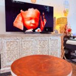Gender Reveal Ultrasound Perth – Capture Joyful Moments at Cedar4D Ultrasound